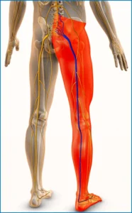 Sciatica Symptoms: Shooting Leg Pain From the Back Explained