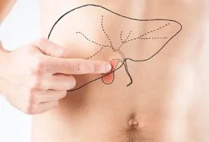 Gallstones Symptoms – Sharp Pain After Fatty Meals
