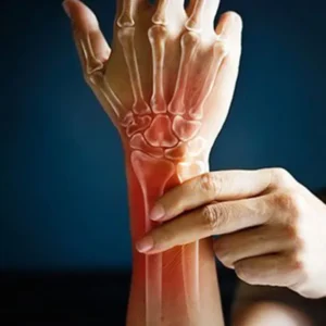 Rheumatoid Arthritis Symptoms – Morning Stiffness And Joint Swelling