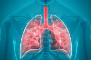 Pneumonia Symptoms – Lung Infection Warning Signs Explained
